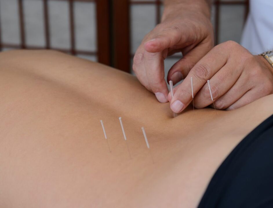 akupunktura na zapalenie gruczołu krokowego