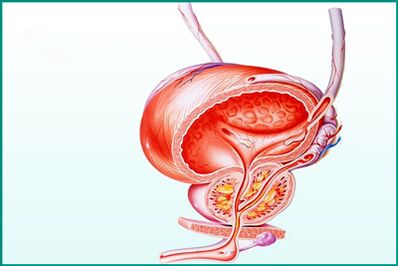 Zapalenie prostaty w ostrym zapaleniu gruczołu krokowego jest ograniczeniem seksu